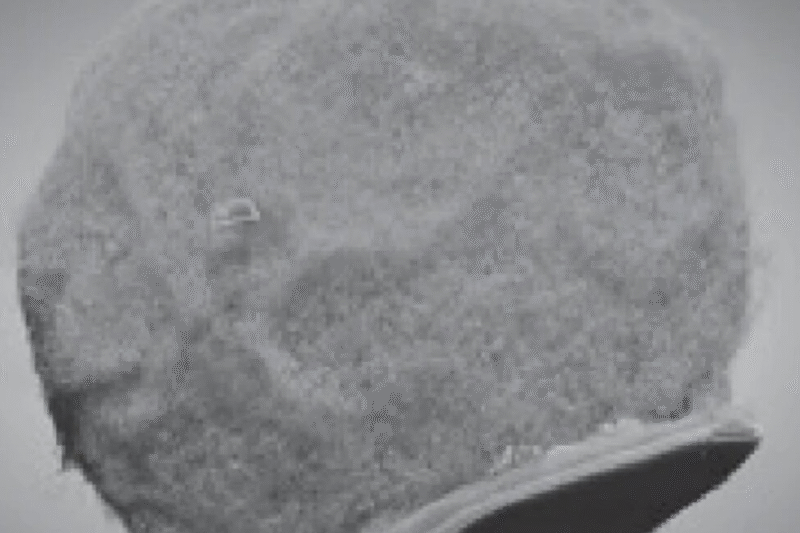 Мікроскопічні чіпи подорожують до мозку через кров